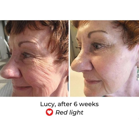 NIB Predire Paris 8 Element Treatment Led Mask - Picture 5 of 15